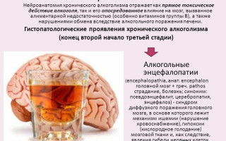 Признаки алкогольной токсической энцефалопатии