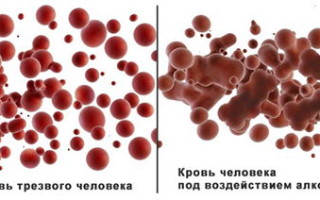Виды анализов крови на наличие алкоголя (CDT) и расшифровка показателей